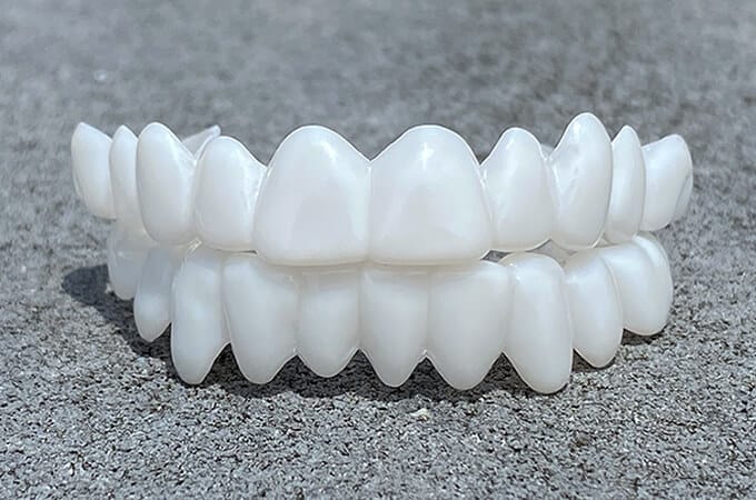 Nakładki na zęby DentAlign – naturalne dopasowanie i komfort