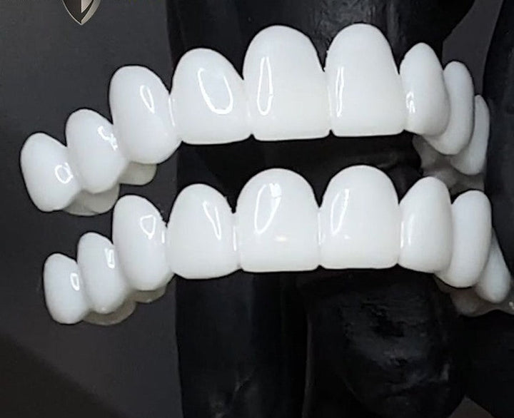 Nakładki na zęby DentAlign – naturalne dopasowanie i komfort