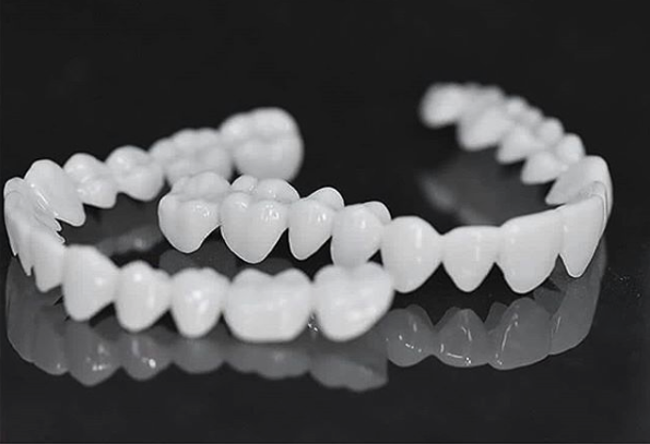 Nakładki na zęby DentAlign – naturalne dopasowanie i komfort