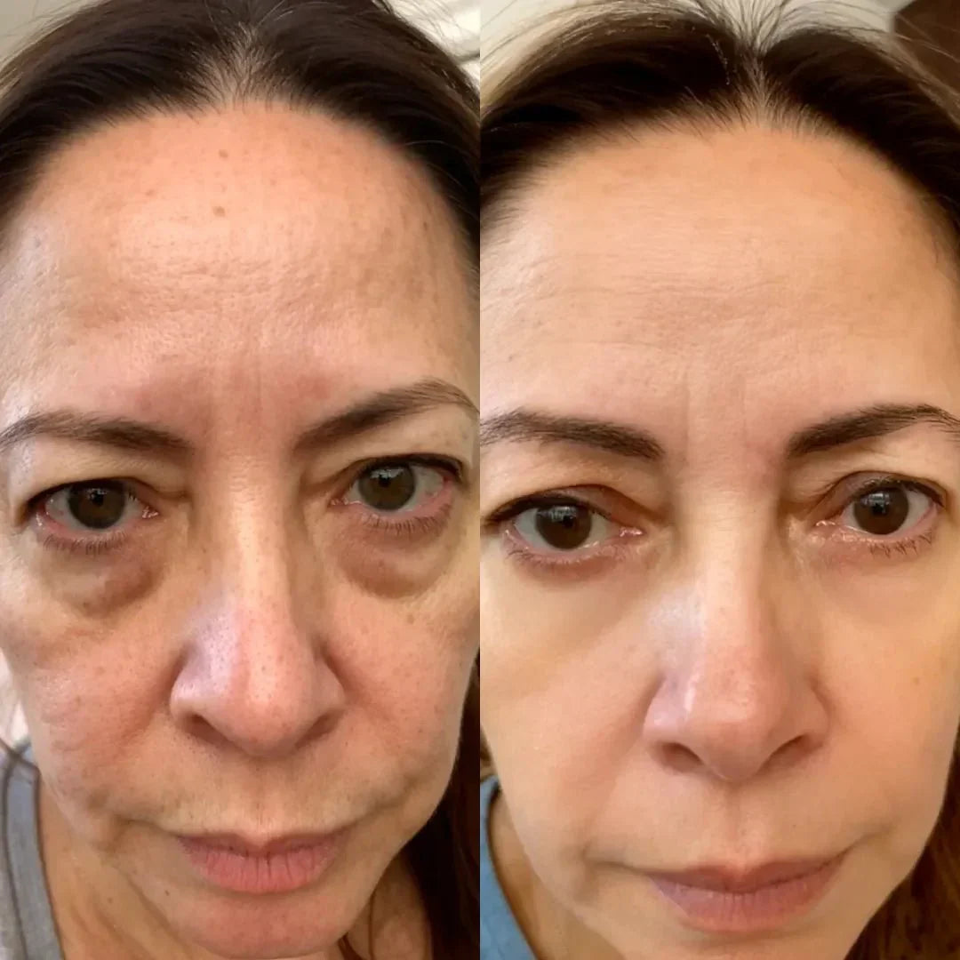 LumaNova Eye Rejuvenator do terapii światłem czerwonym i mikroprądem