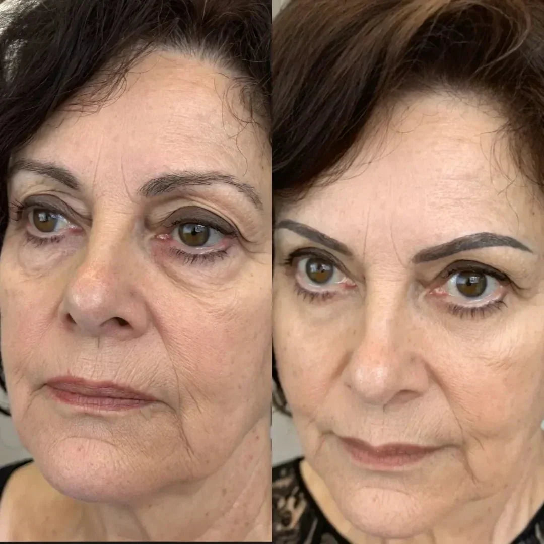 LumaNova Eye Rejuvenator do terapii światłem czerwonym i mikroprądem