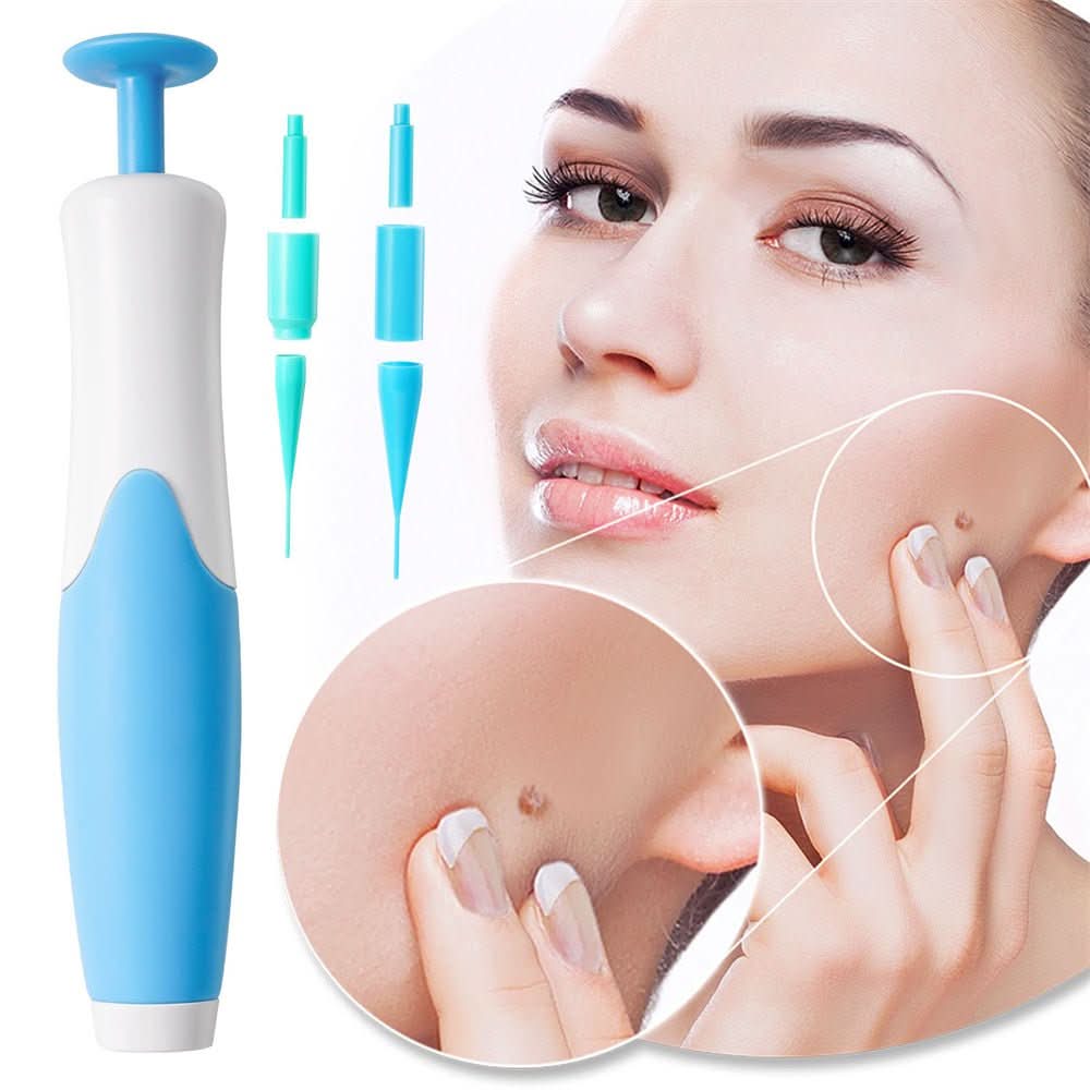 Dermaswift – Usuń przebarwienia skórne, brodawki i narośla skórne