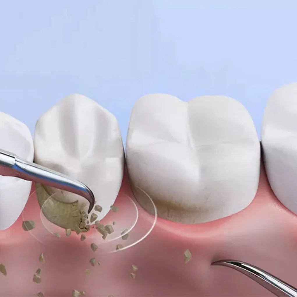 Narzędzie do usuwania osadu dentystycznego
