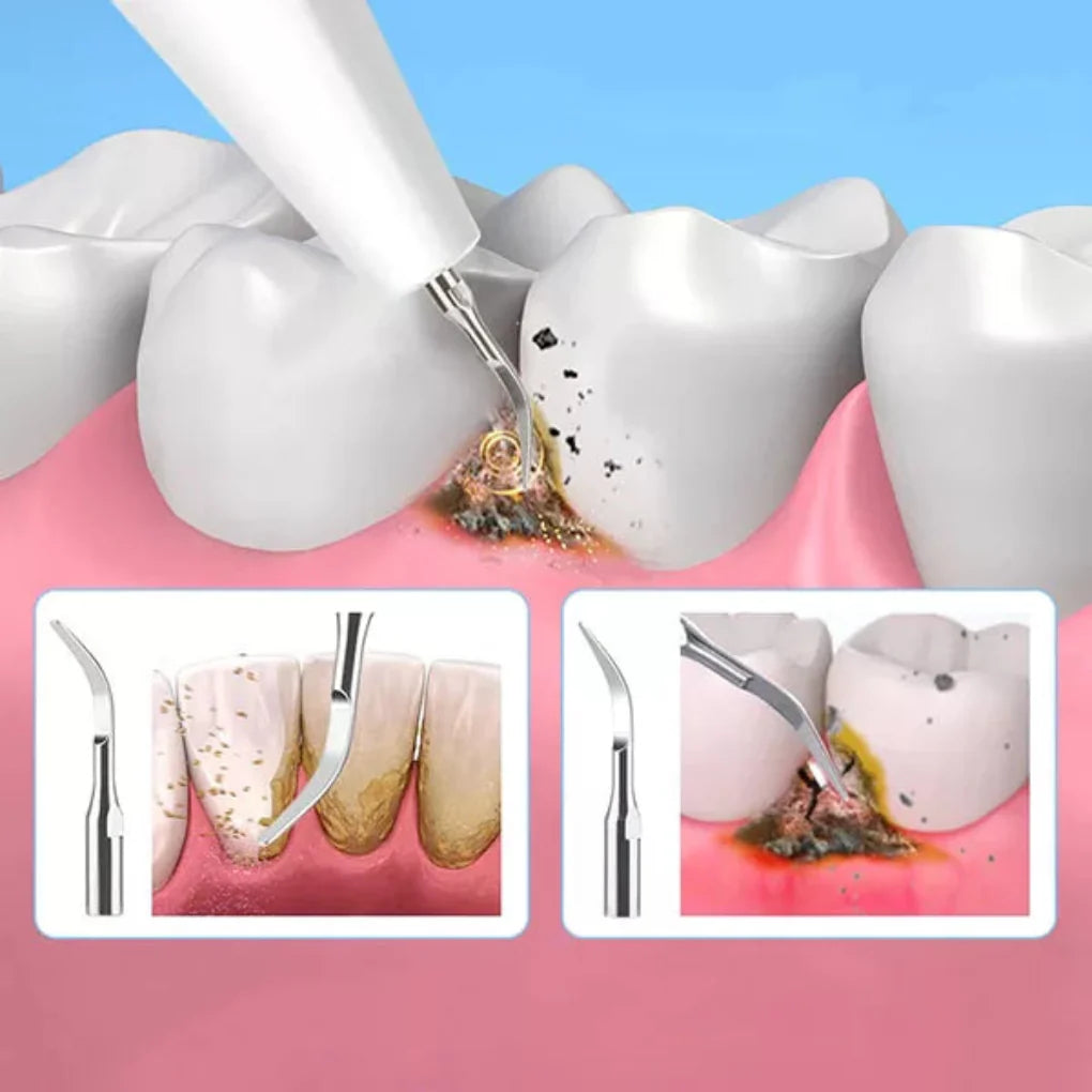 Narzędzie do usuwania osadu dentystycznego